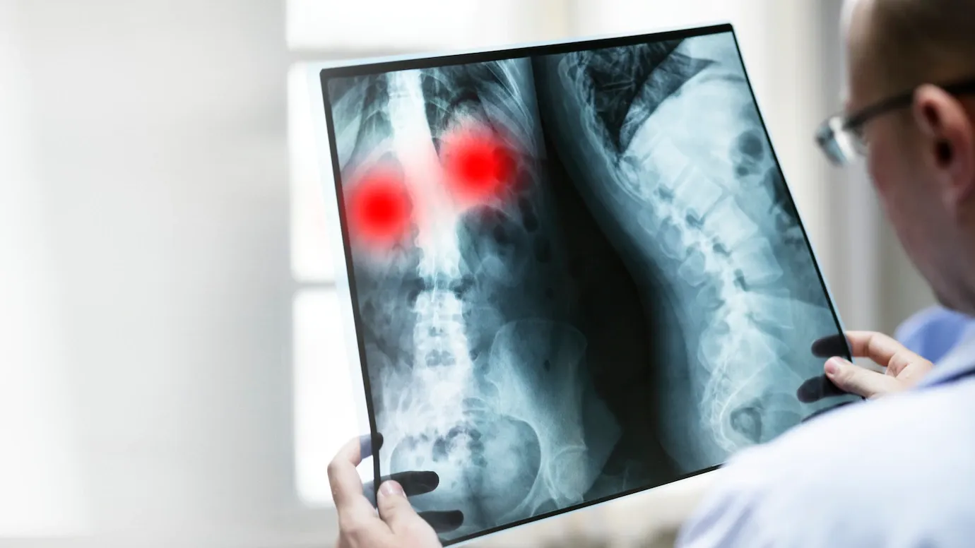 Doctor examining a spine X-ray