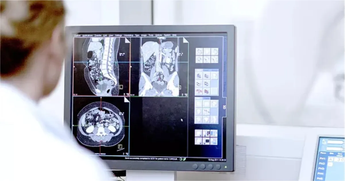 Picture Archiving and Communication System (PACS) – RASTER